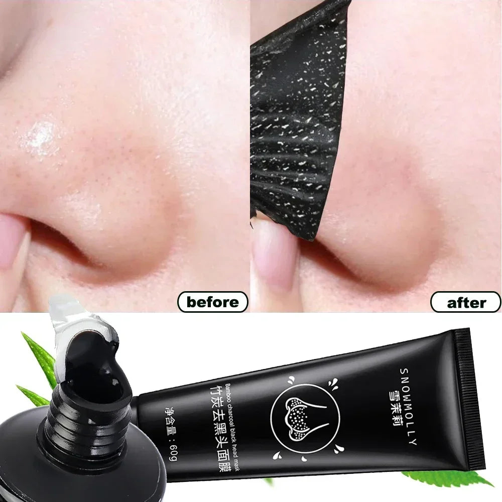 Blackhead Cream Remover